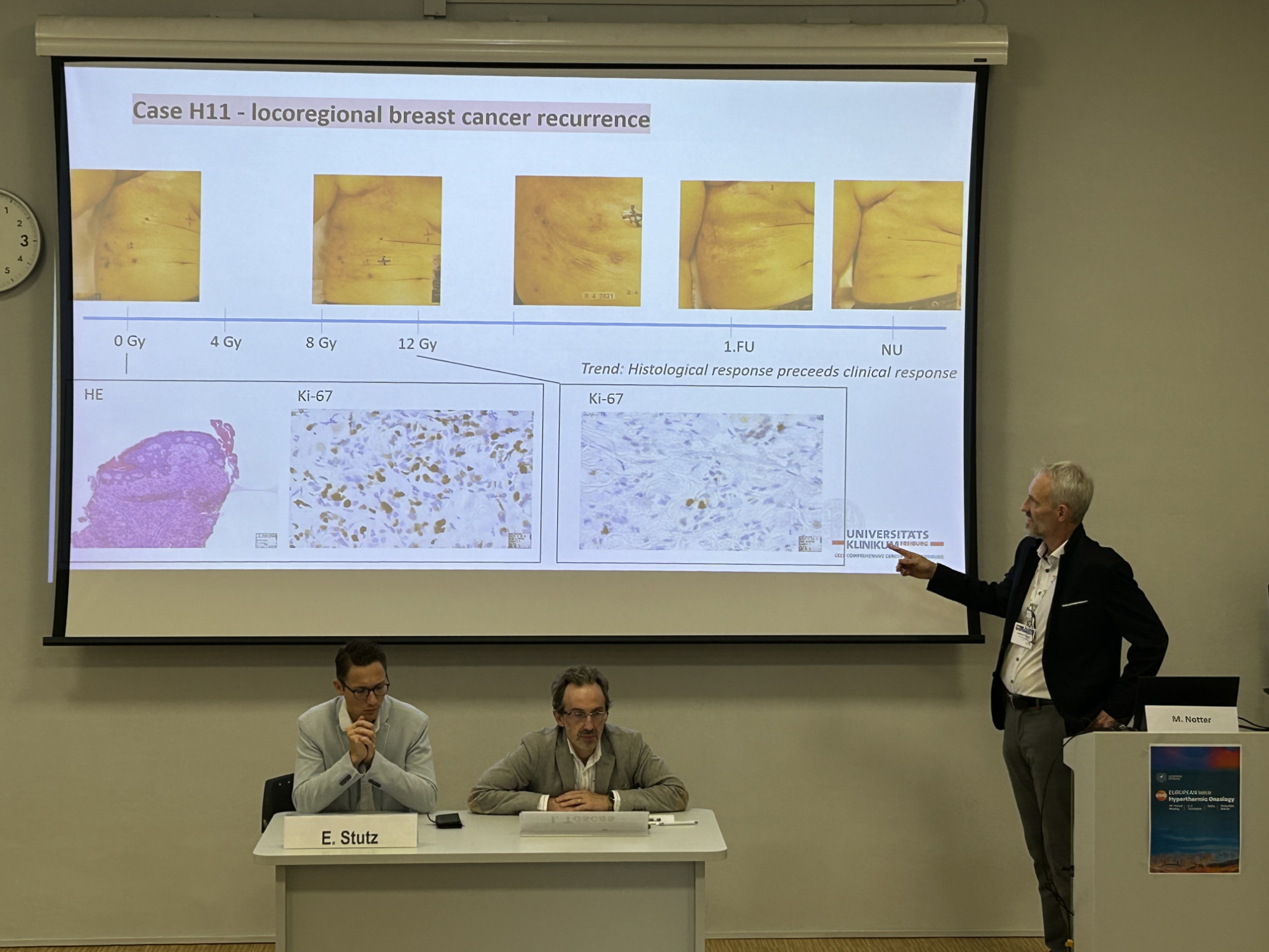 heckel news 2025 ESHO24 Lecture of Dr Andreas Thomsen on HISTOTHERM study in Freiburg